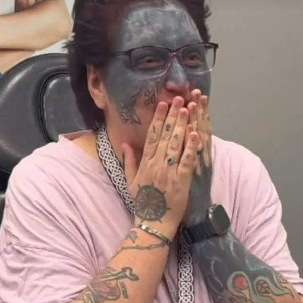 Taylor White, ciudadana estadounidense, recibió sorpresa para eliminar su tatuaje indeseado en la cara