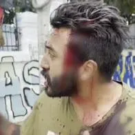 Iván Díaz candidato al Concejo de Bogotá por el Centro Democrático denunció que cerca a la Universidad Pedagógica unos hombres lo agredieron. 