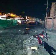 Manizales hoy:  motociclista que perdió piernas en grave accidente de tránsito
