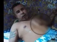 Recluso se enterró una varilla en el abdomen para exigir su traslado a cárcel de Ibagué 