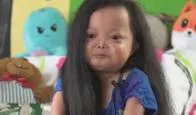 “A mí solo me faltó estatura”: así es Diana Moreno, la mujer más pequeña del país