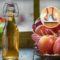 Vinagre de manzana para sirve para bajar de peso: médico dice si funciona