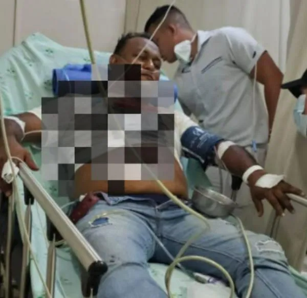 César Augusto Polo Tafur, el exjugador que fue atacado por ladrones.