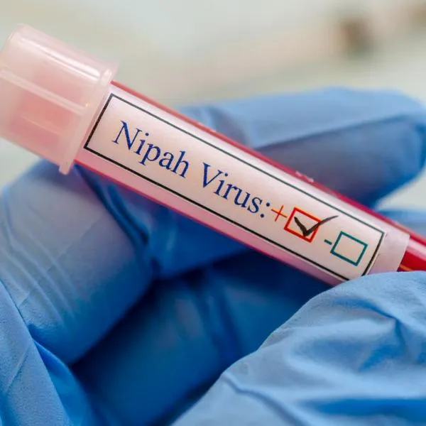 Virus Nipah Colombia: qué tantas muertos puede dejar vs. COVID-19 en la pandemia
