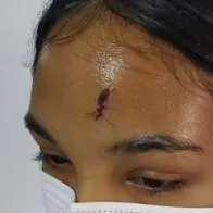 En Valledupar, joven se salvó de morir por bala perdida tras persecución