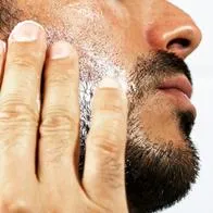 Advierten por efecto (preocupante) del minoxidil, producto que usan muchos hombres