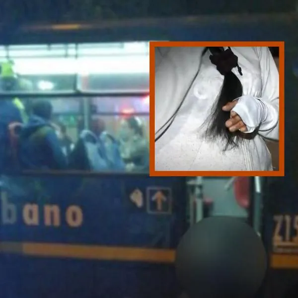 Mujer se enfrentó a ladrones en bus del SITP en Bogotá y terminó con graves heridas en su mano. Ninguno de los otros pasajeros le brindó ayuda. 