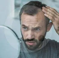 Hombres y mujeres podrían evitar la caída del cabello detectando varias señales y evitando el estrés, mala alimentación y durmiendo poco. 