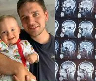 En Reino Unido, a un joven lo operaron de apendicitis y tenía un tumor cerebral, hasta el tercer diagnostico se dieron cuenta.