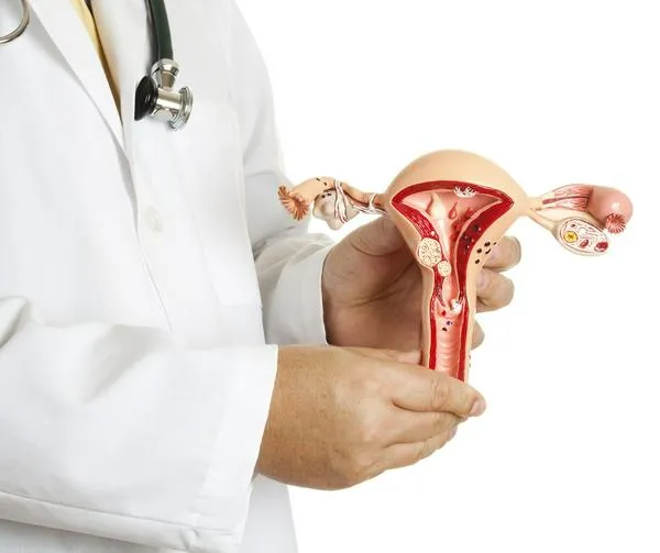 Tumores uterinos en los años de fertilidad, algunos síntomas y cómo tratarlos