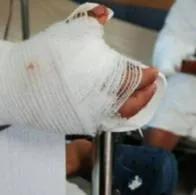 Murieron dos de los cuatro heridos que dejó una explosión de gas en un hotel ubicado en Caño Dulce, Atlántico. Las otras dos personas siguen en el hospital.