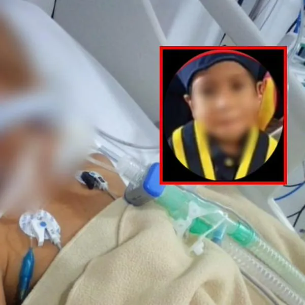 En Yumbo: un menor golpeado por otros niños en la cabeza, falleció por graves lesiones