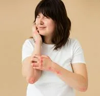 ¿Cómo afecta el estrés a la piel? Síntomas, tratamiento y prevención