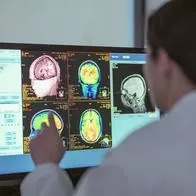 Lo que ocurre en el cerebro de una persona cuando tiene depresión