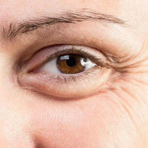 El pepino es conocido por sus propiedades antiinflamatorias y refrescantes para la piel y sus ojos. 