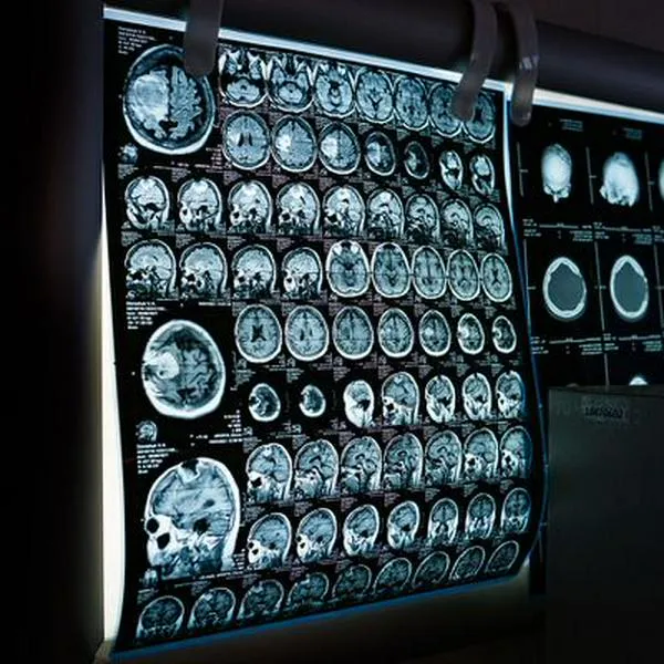Inteligencia artificial podría diagnosticar el cáncer con el doble de precisión