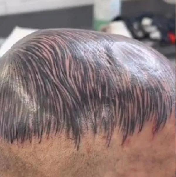 Final inesperado: video de hombre tatuándose "cabello" para ocultar la calvicie se volvió viral