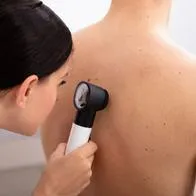 Trabajar bajo el sol causa una de cada tres muertes por cáncer de piel