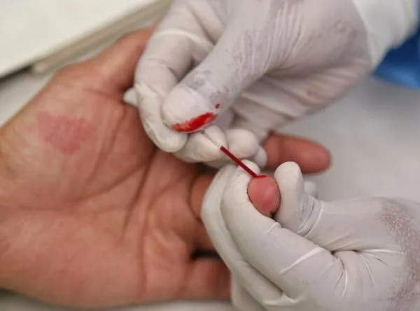 Alerta en Ibagué: aumentó el número de casos de VIH/Sida, vea medidas preventivas 