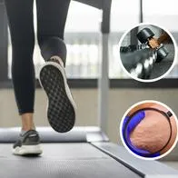 Ejercicios con pesas y el cardio ayuda a combatir la celulitis que se acumula en lugares del cuerpo como los glúteos, las piernas y la cadera.
