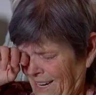 Mujer de 65 años quería estirarse la piel, pero le hicieron la cirugía equivocada.
