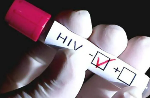 Cali es una de las ciudades de Colombia con mayor número de casos de VIH reportados