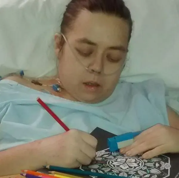 Alexandra Suárez Pereira, la mujer que sufrió mala cirugía en hospital de Bogotá y ahora enfrenta adición por opioides.