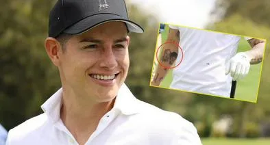 Tatuaje de James Rodríguez es comparado con Iván Mejía: "No sabía que lo quería tanto"