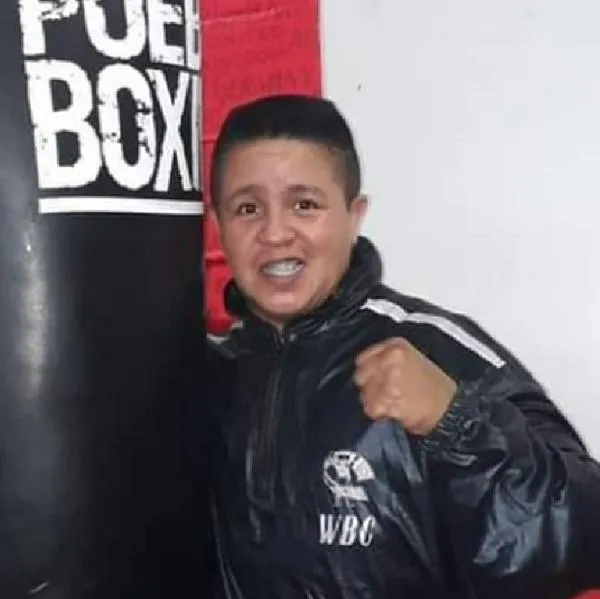 Hieren en atraco a Darys Pardo, colombiana excampeona de boxeo; no opuso resistencia.