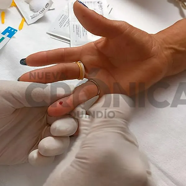 VIH en el Quindío: autoridades alertaron incremento de casos, van 332