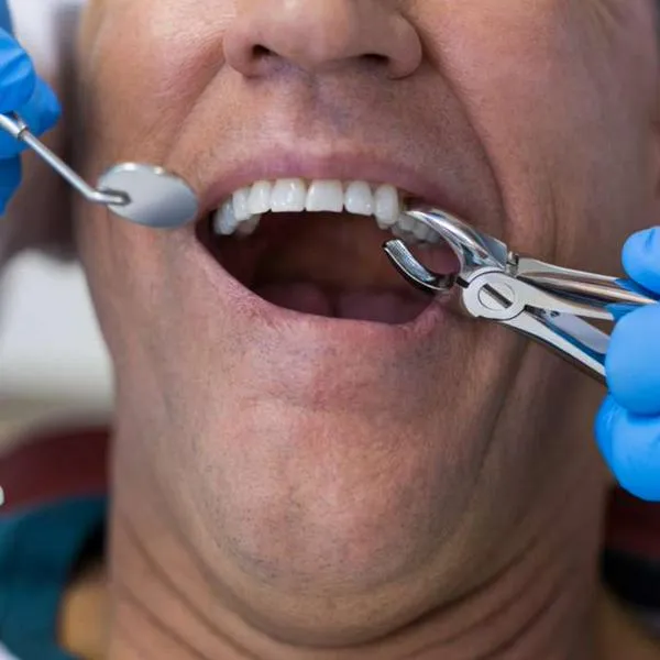 Foto de procedimiento dental. en nota de por qué no tener relaciones íntimas cuando sacan una muela: esto es lo recomendable