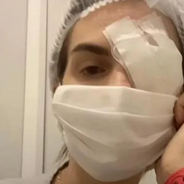 Una mujer dijo que casi muere y hasta quedó en coma luego de tomar ibuprofeno