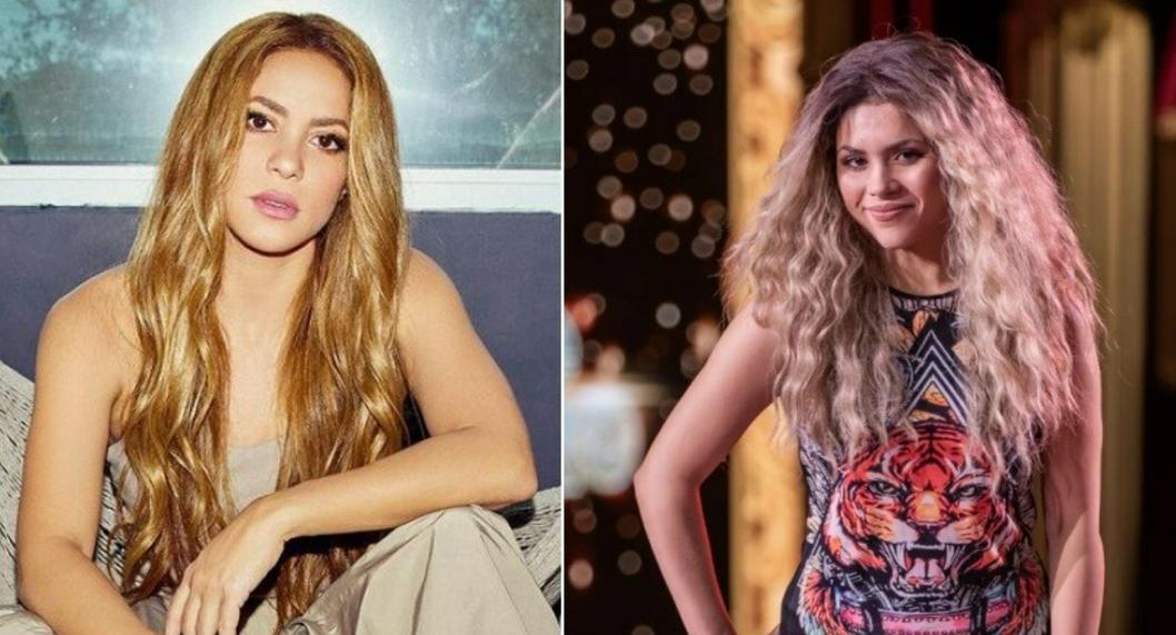 Shakira de 'Yo me llamo' de Caracol Televisión, se sometió a cirugía estética