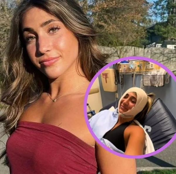 Influencer acabó en el hospital y con la mandíbula dislocada por insólito motivo
