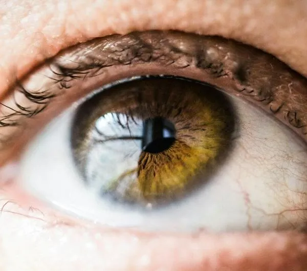 ¿Quiere cambiarse el color de los ojos? Esto cuesta la cirugía