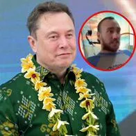 Así luce el primer humano con un chip de Elon Musk implantado en el cerebro