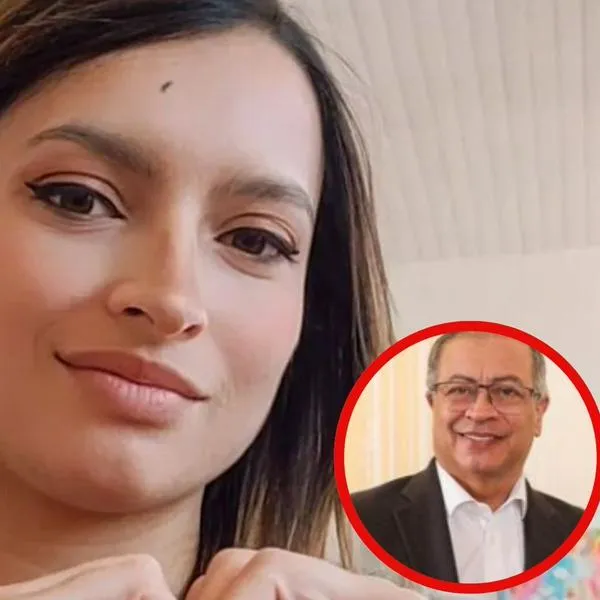 Andrea Petro habló del implante capilar de su papá, Gustavo Petro.