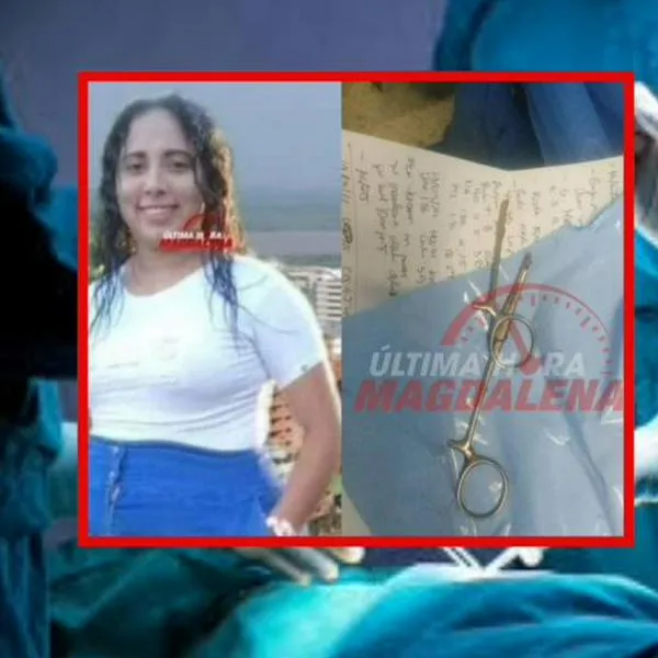 A joven le descubren después de un año unas tijeras quirúrgicas dentro de su cuerpo 