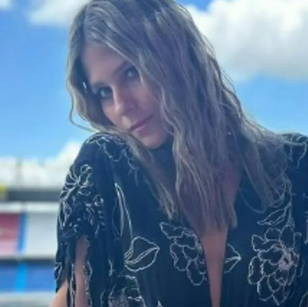 Andrea Guerrero preocupó por accidente que sufrió