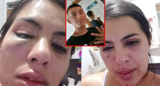 Mujer pidió auxilio por Facebook por un presunto ataque de su pareja: hay fotos