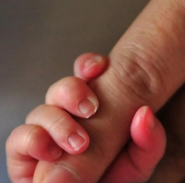 Mamá de bebé recién nacido lo mordió e intentó matarlo; papá del menor lo salvó