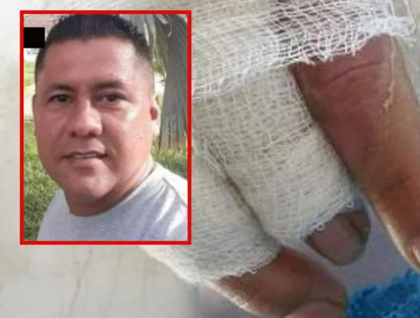 ¡Urgente! El hombre al que le prendieron fuego en el Tolima necesita donantes de sangre 