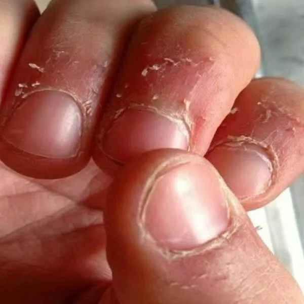 ¿Cómo me quito los ´padrastros' de las uñas? Con aceite mineral y agua tibia