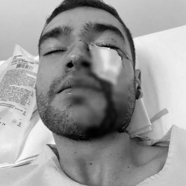 Delincuentes golpearon a hijo de coronel (r) en Bogotá: tiene cuatro fracturas en la cara