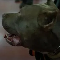 Hombre atacado por sus 2 pitbull en Bogotá está grave y perdería brazo; los perros murieron