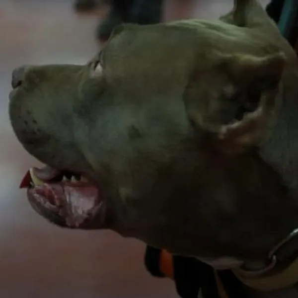 Hombre atacado por sus dos mascotas en Bogotá podría perder un brazo; está bajo pronóstico reservado