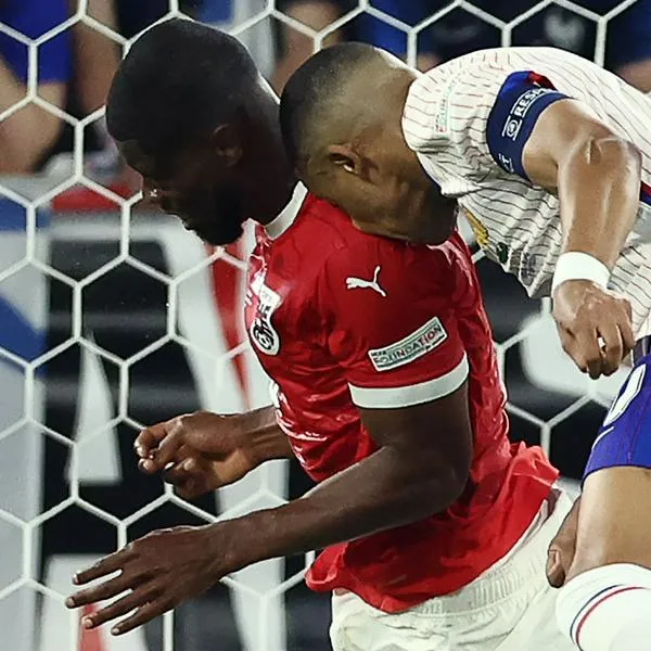 Así le quedó la nariz a Kylian Mbappé luego de golpe en Eurocopa; impresionante foto