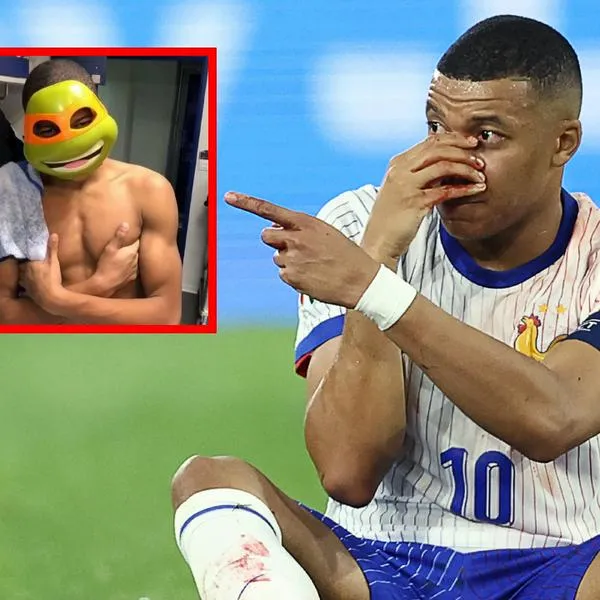 Memes de Kylian Mbappé por fractura de nariz en partido de Francia contra Austria: fotos y videos