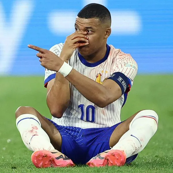 Francia tomó decisión con Kylian Mbappé para la Eurocopa, luego de fractura de nariz