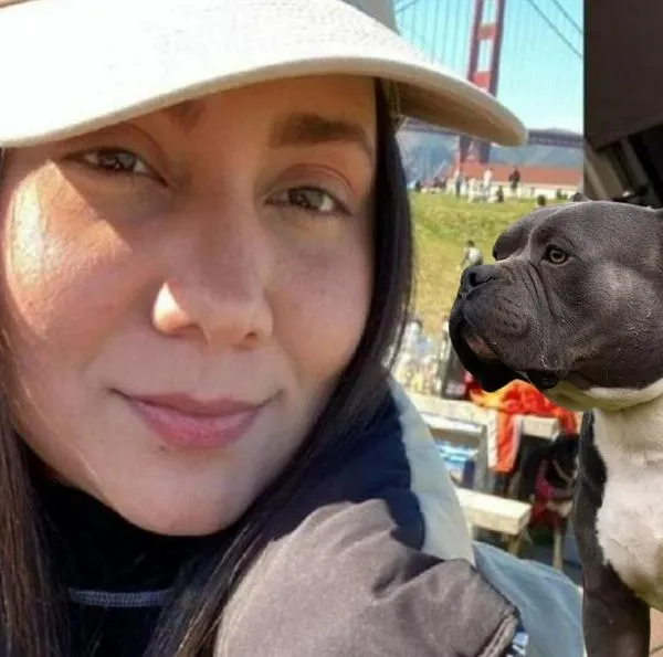 Colombiana en UCI de EE. UU. al ser atacada por sus perros y familiares piden ayuda